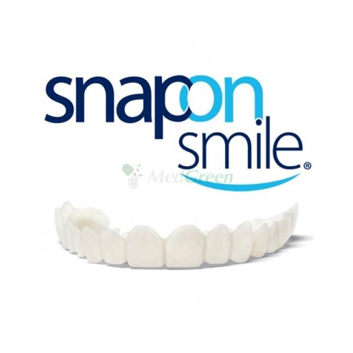 ✦ Snap-On Smile - veneers